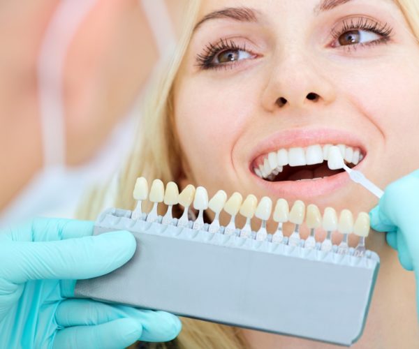 Highmoor-Dental-teeth-whitening-laser-edmonton