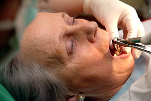 geriatric-dentistry