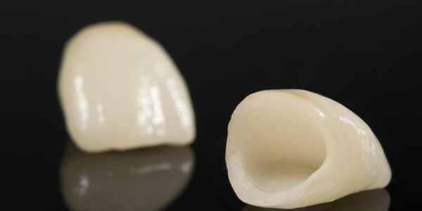 dental-crowns-min-925x425