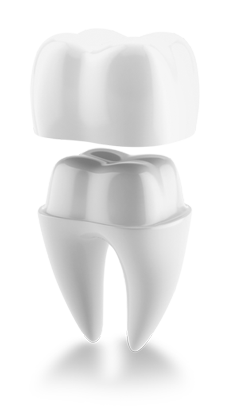 dentalcrowns